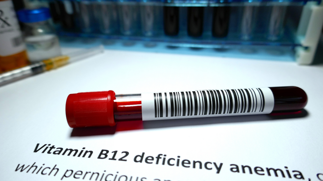 Vitamin B12 Deficiency: Signs, Symptoms, and Diagnosis