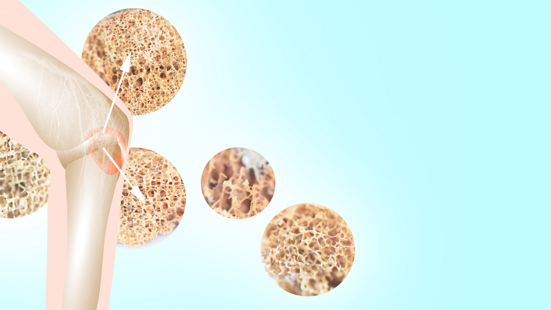 Vitamin B12 and Bone Health: Beyond Calcium and Vitamin D