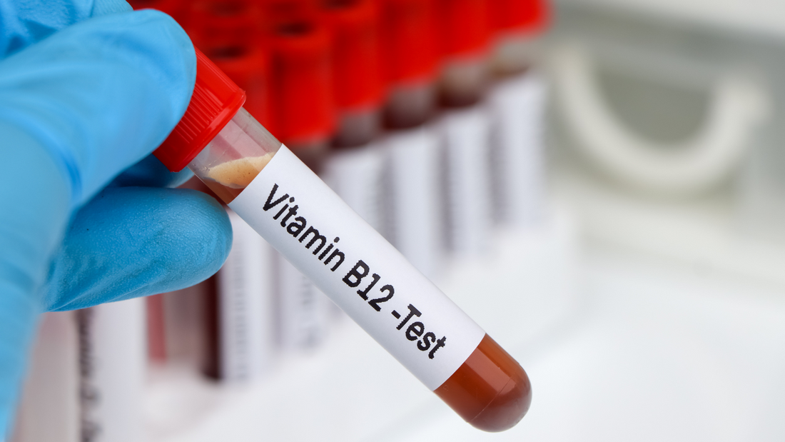 Vitamin B12 Testing: Methods, Accuracy, and Interpretation